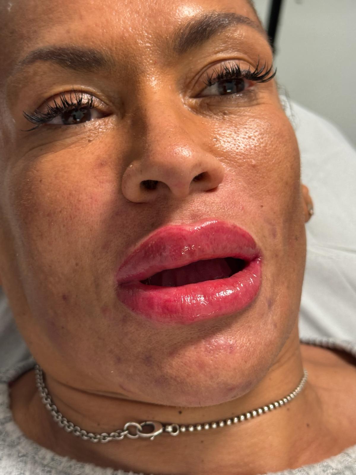 After lip blush
